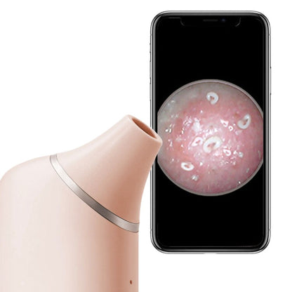 SkinClear - Camera AI Visual Blackhead Remover